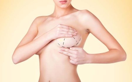 Breast Augmentation Trends: What You Need to Know from the Best Doctors in Dubai