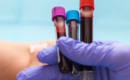 How Blood Test at Home in Dubai Saves You Time